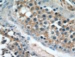 DMXL2 Antibody in Immunohistochemistry (Paraffin) (IHC (P))