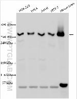 DMXL2 Antibody in Western Blot (WB)