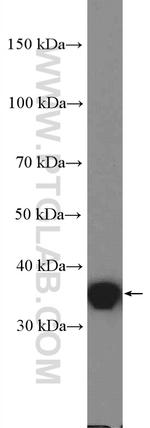 PSRC1 Antibody in Western Blot (WB)