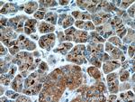 FAM3B Antibody in Immunohistochemistry (Paraffin) (IHC (P))