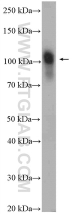 Nesprin 3 Antibody in Western Blot (WB)