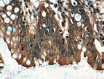 CARMIL Antibody in Immunohistochemistry (Paraffin) (IHC (P))