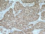 NEK1 Antibody in Immunohistochemistry (Paraffin) (IHC (P))