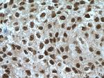 NEK1 Antibody in Immunohistochemistry (Paraffin) (IHC (P))