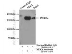 NEK1 Antibody in Immunoprecipitation (IP)
