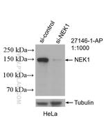 NEK1 Antibody in Western Blot (WB)