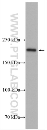 NEK1 Antibody in Western Blot (WB)
