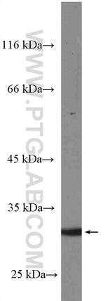 PRTN3 Antibody in Western Blot (WB)