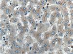 Factor XII Antibody in Immunohistochemistry (Paraffin) (IHC (P))