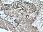 ATM Antibody in Immunohistochemistry (Paraffin) (IHC (P))