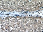 ATM Antibody in Immunohistochemistry (Paraffin) (IHC (P))