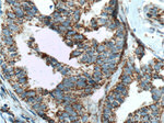 TBXA2R Antibody in Immunohistochemistry (Paraffin) (IHC (P))