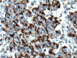 TBXA2R Antibody in Immunohistochemistry (Paraffin) (IHC (P))