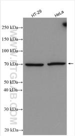 TBXA2R Antibody in Western Blot (WB)