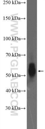 TBXA2R Antibody in Western Blot (WB)