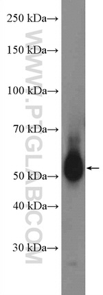 TBXA2R Antibody in Western Blot (WB)