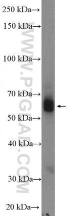 TBXA2R Antibody in Western Blot (WB)