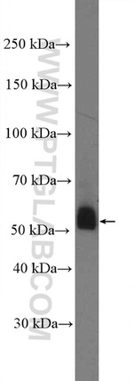 TBXA2R Antibody in Western Blot (WB)