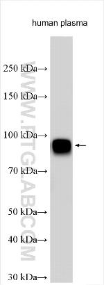 CPN2 Antibody in Western Blot (WB)