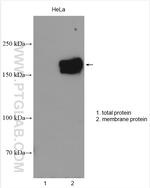 MRP4 Antibody in Western Blot (WB)