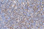 Nectin 2 Antibody in Immunohistochemistry (Paraffin) (IHC (P))