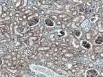 Nectin 2 Antibody in Immunohistochemistry (Paraffin) (IHC (P))