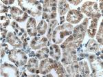TMIGD1 Antibody in Immunohistochemistry (Paraffin) (IHC (P))
