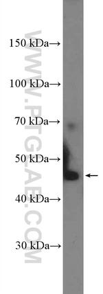 TMIGD1 Antibody in Western Blot (WB)