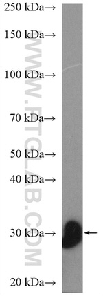 TMIGD1 Antibody in Western Blot (WB)