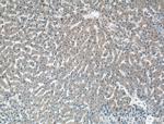 C2 Antibody in Immunohistochemistry (Paraffin) (IHC (P))