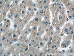 C2 Antibody in Immunohistochemistry (Paraffin) (IHC (P))