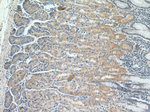 ST14 Antibody in Immunohistochemistry (Paraffin) (IHC (P))