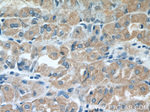 ST14 Antibody in Immunohistochemistry (Paraffin) (IHC (P))