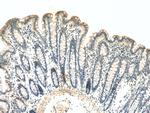 ST14 Antibody in Immunohistochemistry (Paraffin) (IHC (P))