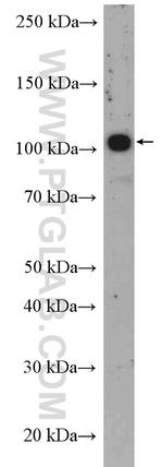 ST14 Antibody in Western Blot (WB)