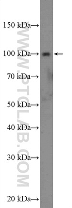 ST14 Antibody in Western Blot (WB)