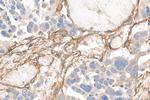 CD90/Thy1 Antibody in Immunohistochemistry (Paraffin) (IHC (P))