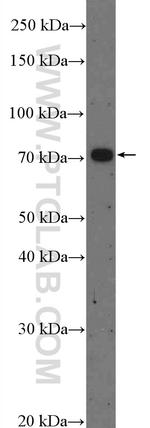 ZDHHC8 Antibody in Western Blot (WB)