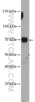 ZDHHC8 Antibody in Western Blot (WB)