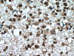 MSI1 Antibody in Immunohistochemistry (Paraffin) (IHC (P))
