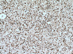 MSI1 Antibody in Immunohistochemistry (Paraffin) (IHC (P))
