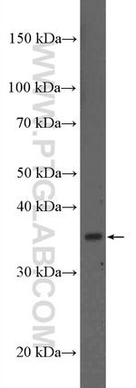 MSI1 Antibody in Western Blot (WB)