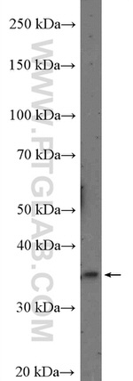 MSI1 Antibody in Western Blot (WB)