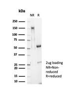 Glypican-3 (GPC3) (Hepatocellular Carcinoma Marker) Antibody in SDS-PAGE (SDS-PAGE)
