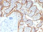 Glypican-3 (GPC3) (Hepatocellular Carcinoma Marker) Recombinant Rabbit Monoclonal Antibody (GPC3/7991R)