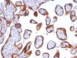 Glypican-3 (GPC3) (Hepatocellular Carcinoma Marker) Antibody in Immunohistochemistry (Paraffin) (IHC (P))