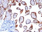 Glypican-3 (GPC3) (Hepatocellular Carcinoma Marker) Antibody in Immunohistochemistry (Paraffin) (IHC (P))