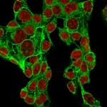 Glypican-3 (GPC3) Recombinant Rabbit Monoclonal Antibody (GPC3, 1534R)