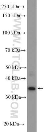 CCDC92 Antibody in Western Blot (WB)