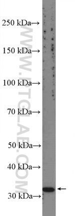 CCDC92 Antibody in Western Blot (WB)